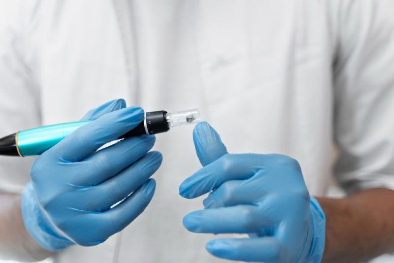Microneedling with PRP Treatment