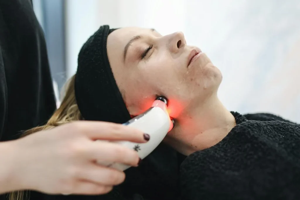 lumecca ipl recovery