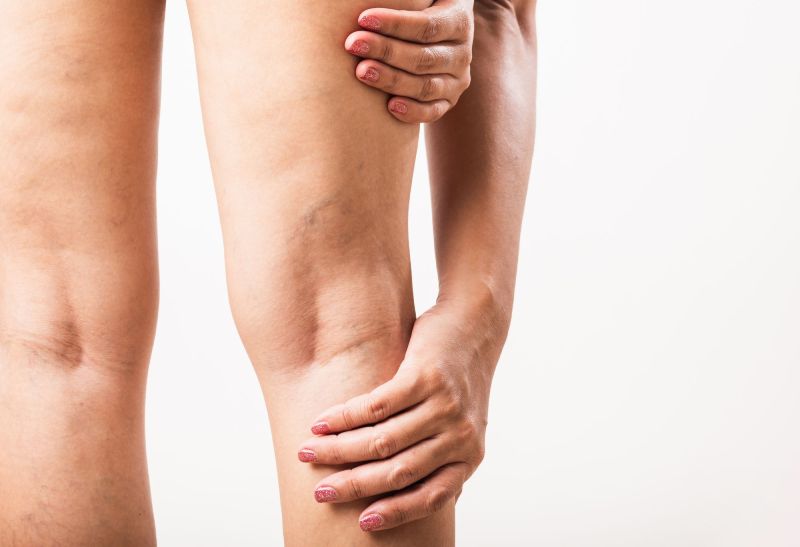 lumecca treatment