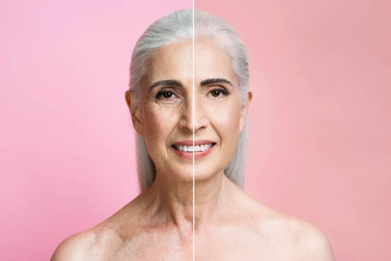 morpheus8 skin tightening