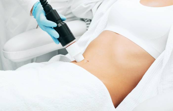 Stretch Mark Removal