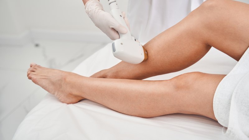 Diolaze Laser Hair Removal in Bradenton