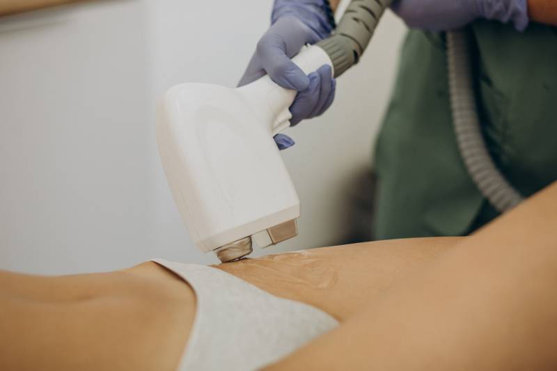 Diolaze Bikini Line Treatments