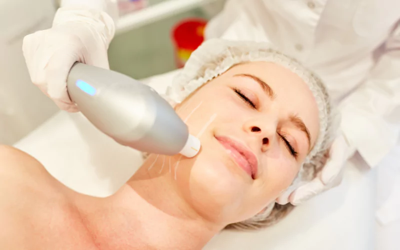 Non-Surgical Skin Tightening with Forma in Bradenton