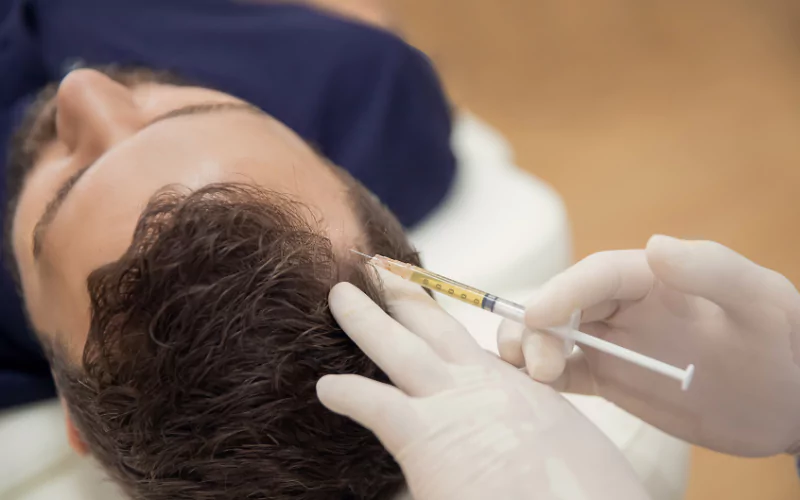 Benefits of PRF Treatment