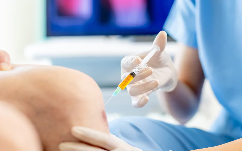 Joint Relief Through PRP: A Natural Treatment for Arthritis Pain1
