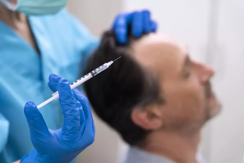 PRF Treatment