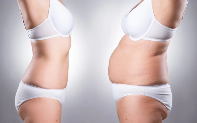 When Does Semaglutide Start Working for Weight Loss? What to Expect