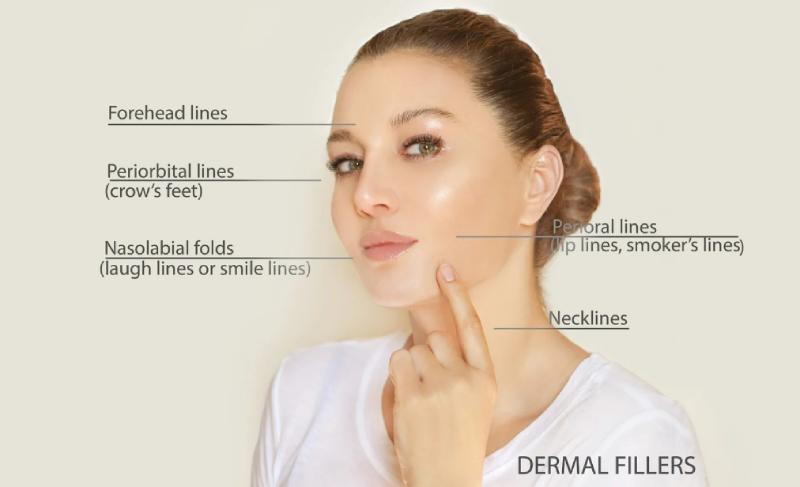 Botox vs. Fillers