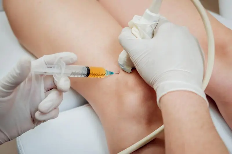 prf treatment for joints