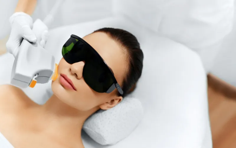 radiesse filler