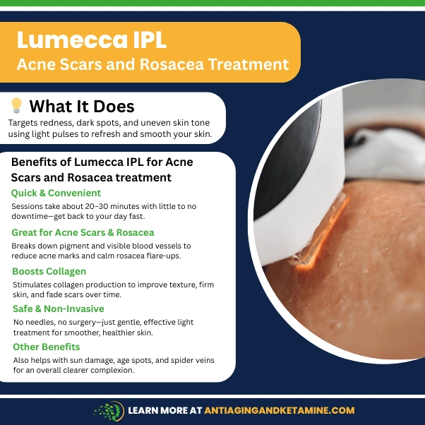 lumecca ipl