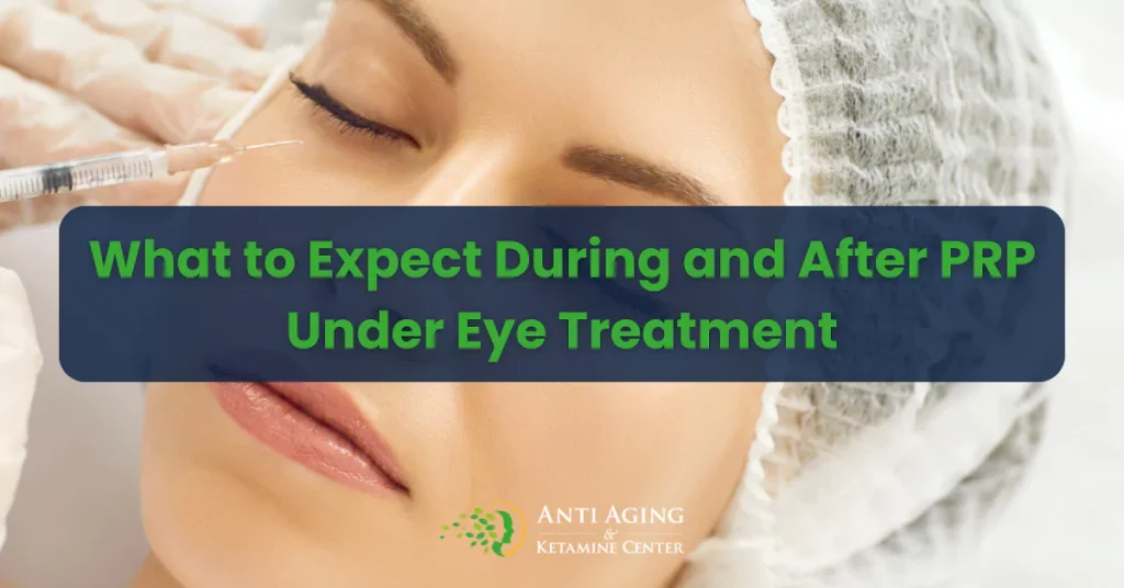 What to Expect During and After PRP Under Eye Treatment