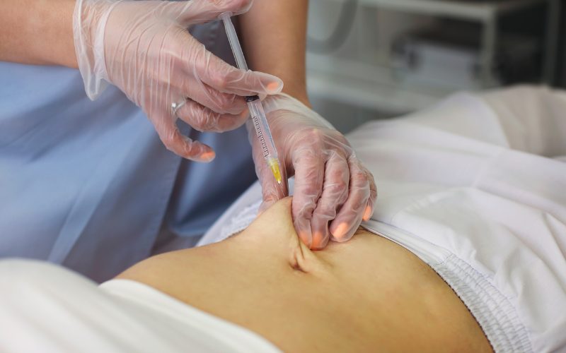 Medical professional administering lipotropic injection to patient’s abdomen, highlighting wellness treatment for fat metabolism and energy enhancement.