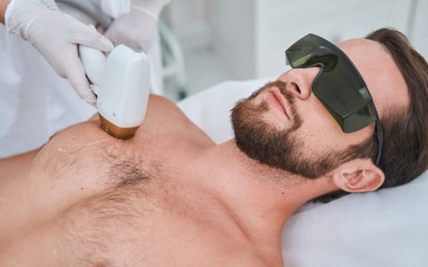 man getting hair removed with diolaze laser